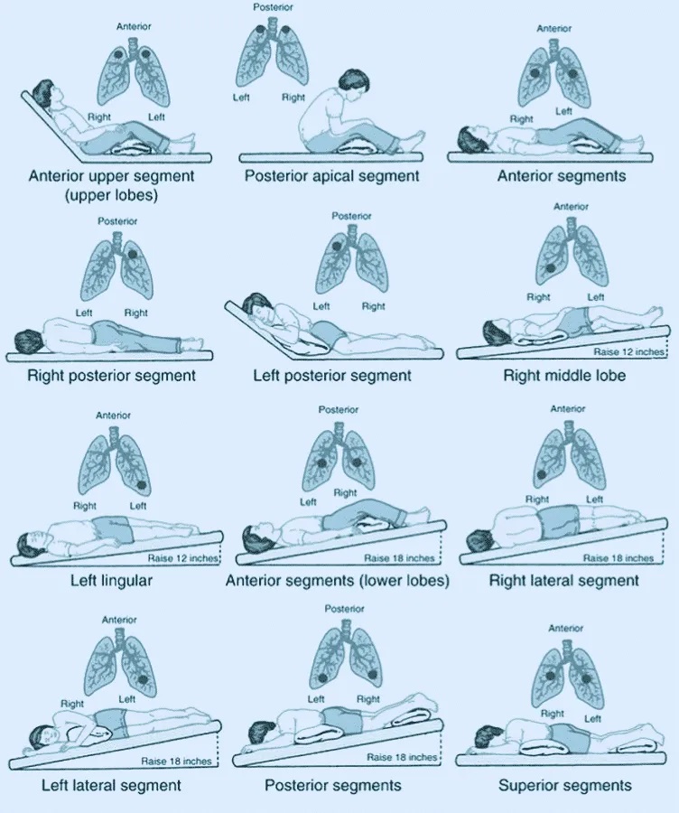 does respiratory therapy still do chest percussion